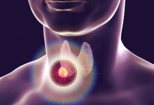 ivermectin for thyroid cancer