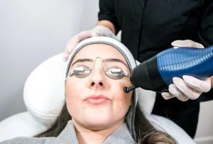 laser skin resurfacing
